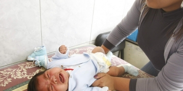 La detección de anemia infantil es inmediata con el uso del globulinómetro en las diferentes postas de salud.